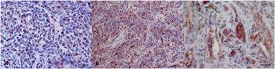 Molecular and Immunohistochemical Expression of LTA4H and FXR1 in Canine Oral Melanoma